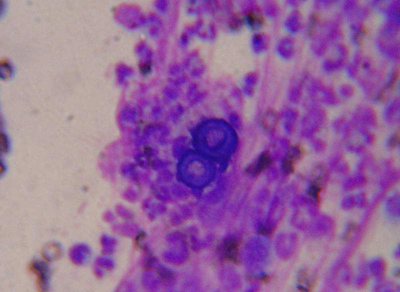 Blastomyces dermatitidis, el agente causal de la blastomicosis. Wikimedia Commons